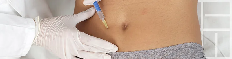 Intradermoterapia — Dra. Mayra Tosta