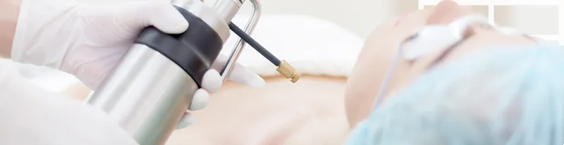 Crioterapia — Dra. Mayra Tosta